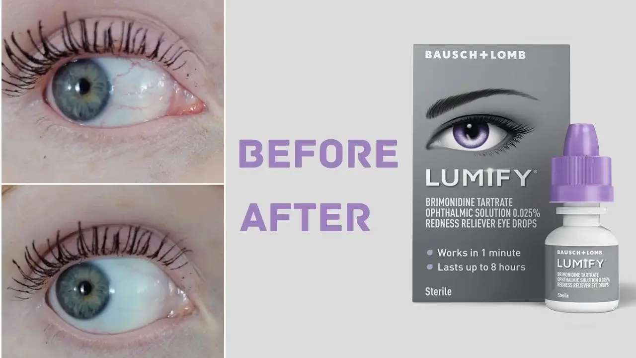 pros and cons of lumify eye drops