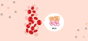 Mean corpuscular hemoglobin (MCH)